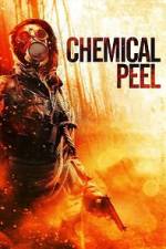 Watch Chemical Peel 123moviesFree