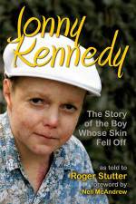 Watch The Boy Whose Skin Fell Off 123moviesFree