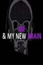 Watch Me & My New Brain 123moviesFree