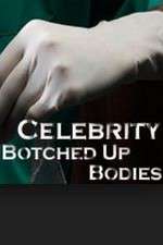 Watch Celebrity Botched Up Bodies 123moviesFree